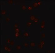 Anti-PLAC2 antibody produced in rabbit affinity isolated antibody, buffered aqueous solution