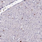 Anti-APOBR antibody produced in rabbit Prestige Antibodies&#174; Powered by Atlas Antibodies, affinity isolated antibody, buffered aqueous glycerol solution