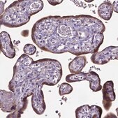 Anti-ADAM12 antibody produced in rabbit Prestige Antibodies&#174; Powered by Atlas Antibodies, affinity isolated antibody, buffered aqueous glycerol solution