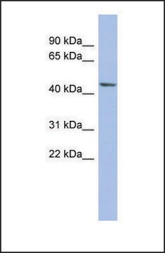 Anti-BEST3, (N-terminal) antibody produced in rabbit affinity isolated antibody