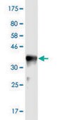 Monoclonal Anti-USP47 antibody produced in mouse clone 1E6, purified immunoglobulin, buffered aqueous solution