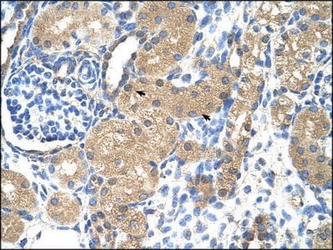 Anti-TNNI1 (AB1) antibody produced in rabbit affinity isolated antibody