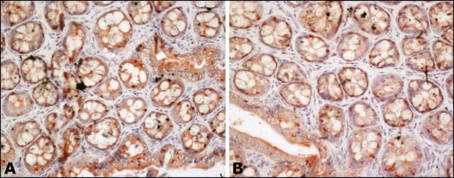 Anti-FUS antibody produced in rabbit ~1.0&#160;mg/mL, affinity isolated antibody