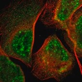 Anti-LDOC1L antibody produced in rabbit Prestige Antibodies&#174; Powered by Atlas Antibodies, affinity isolated antibody, buffered aqueous glycerol solution