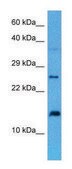 Anti-RPS27A antibody produced in rabbit affinity isolated antibody