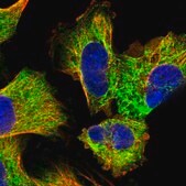 Anti-EXOSC4 antibody produced in rabbit Prestige Antibodies&#174; Powered by Atlas Antibodies, affinity isolated antibody, buffered aqueous glycerol solution