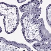 Anti-BCL2L14 antibody produced in rabbit Prestige Antibodies&#174; Powered by Atlas Antibodies, affinity isolated antibody, buffered aqueous glycerol solution