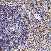 Anti-MEF2A+MEF2C Antibody, clone 10I9G9, Rabbit Monoclonal