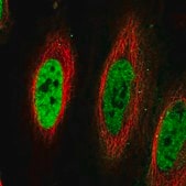 Anti-TDG antibody produced in rabbit Prestige Antibodies&#174; Powered by Atlas Antibodies, affinity isolated antibody, buffered aqueous glycerol solution