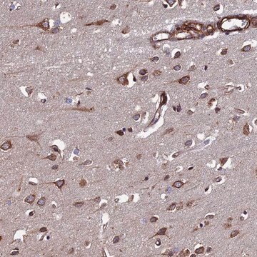 Anti-CTDP1 antibody produced in rabbit Prestige Antibodies&#174; Powered by Atlas Antibodies, affinity isolated antibody, buffered aqueous glycerol solution