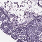 Anti-ATP6V1D antibody produced in rabbit Prestige Antibodies&#174; Powered by Atlas Antibodies, affinity isolated antibody, buffered aqueous glycerol solution