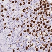 Anti-MUC21 antibody produced in rabbit Prestige Antibodies&#174; Powered by Atlas Antibodies, affinity isolated antibody, buffered aqueous glycerol solution