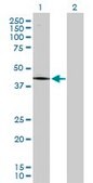 Anti-PCYT1A antibody produced in rabbit purified immunoglobulin, buffered aqueous solution
