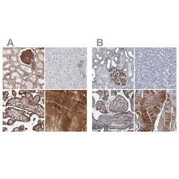 Anti-PLEC antibody produced in rabbit Prestige Antibodies® Powered by Atlas Antibodies, affinity isolated antibody, buffered aqueous glycerol solution, ab1