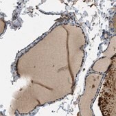 Anti-MAN2A2 antibody produced in rabbit Prestige Antibodies&#174; Powered by Atlas Antibodies, affinity isolated antibody, buffered aqueous glycerol solution