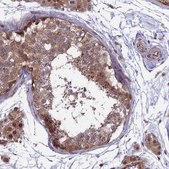 Anti-MAST2 antibody produced in rabbit Prestige Antibodies® Powered by Atlas Antibodies, affinity isolated antibody, buffered aqueous glycerol solution