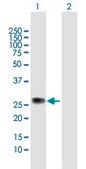 Anti-KIAA1166 antibody produced in mouse IgG fraction of antiserum, buffered aqueous solution