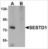Anti-SESTD1 antibody produced in rabbit affinity isolated antibody, buffered aqueous solution