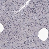 Anti-SULT1E1 antibody produced in rabbit affinity isolated antibody, buffered aqueous glycerol solution, ab2