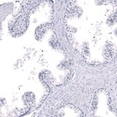 Monoclonal Anti-LHX9 antibody produced in mouse Prestige Antibodies® Powered by Atlas Antibodies, clone CL15043, purified antibody (Protein A)