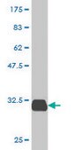 Monoclonal Anti-SPINK1 antibody produced in mouse clone 4D4, purified immunoglobulin, buffered aqueous solution
