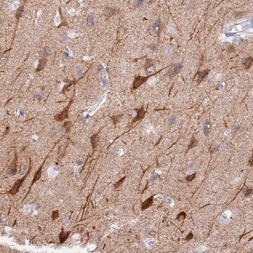 Anti-VPS33B antibody produced in rabbit Prestige Antibodies&#174; Powered by Atlas Antibodies, affinity isolated antibody, buffered aqueous glycerol solution