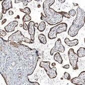 Anti-CXorf21 antibody produced in rabbit affinity isolated antibody, buffered aqueous glycerol solution