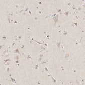 Anti-SLC25A26 antibody produced in rabbit Prestige Antibodies&#174; Powered by Atlas Antibodies, affinity isolated antibody, buffered aqueous glycerol solution
