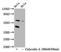 Anti-phospho-EIF2AK2 (T446) antibody, clone 2F8, Rabbit Monoclonal recombinant, expressed in HEK293F cells