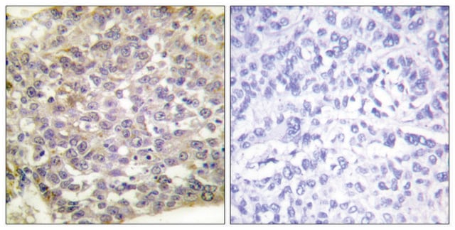 Anti-14-3-3 &#950; antibody produced in rabbit affinity isolated antibody