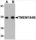 Anti-TMEM184B antibody produced in rabbit affinity isolated antibody, buffered aqueous solution