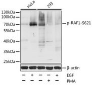 Anti-Phospho-RAF1-S621 antibody produced in rabbit