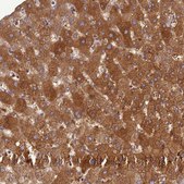 Anti-ADAMTS7 antibody produced in rabbit Prestige Antibodies® Powered by Atlas Antibodies, affinity isolated antibody, buffered aqueous glycerol solution