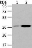 Anti-TBXA2R affinity isolated antibody