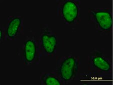 Monoclonal Anti-MPG antibody produced in mouse clone 1E10, purified immunoglobulin, buffered aqueous solution
