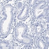 Anti-TSPYL6 antibody produced in rabbit Prestige Antibodies® Powered by Atlas Antibodies, affinity isolated antibody, buffered aqueous glycerol solution