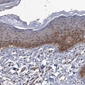 Anti-DGKA antibody produced in rabbit Prestige Antibodies&#174; Powered by Atlas Antibodies, affinity isolated antibody, buffered aqueous glycerol solution