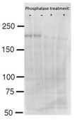 抗磷酸化Brd4（Ser492/Ser494） from rabbit, purified by affinity chromatography