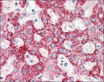 Anti-CRLF2 antibody produced in rabbit affinity isolated antibody