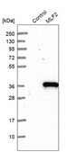 Anti-MLF2 antibody produced in rabbit Ab2, Prestige Antibodies&#174; Powered by Atlas Antibodies, affinity isolated antibody, buffered aqueous glycerol solution