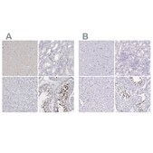 Anti-SPACA1 antibody produced in rabbit Prestige Antibodies® Powered by Atlas Antibodies, affinity isolated antibody, buffered aqueous glycerol solution