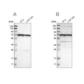 Anti-LRRC47 antibody produced in rabbit Prestige Antibodies® Powered by Atlas Antibodies, affinity isolated antibody, buffered aqueous glycerol solution