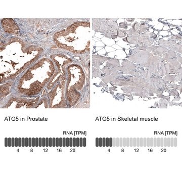 Monoclonal Anti-ATG5 antibody produced in mouse Prestige Antibodies&#174; Powered by Atlas Antibodies, clone CL9508, purified immunoglobulin, buffered aqueous glycerol solution