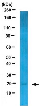 Anti-PLGF Antibody, clone 216-17 clone 216-17, from mouse