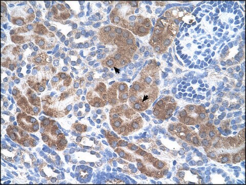 抗 CD36 兔抗 affinity isolated antibody