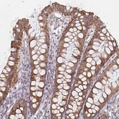 Anti-CTHRC1 antibody produced in rabbit Prestige Antibodies&#174; Powered by Atlas Antibodies, affinity isolated antibody, buffered aqueous glycerol solution