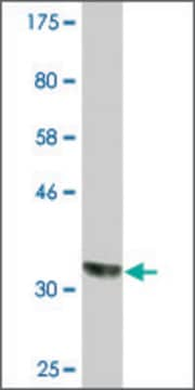 Monoclonal Anti-CSAD, (N-terminal) antibody produced in mouse clone 1D2, ascites fluid