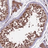 Anti-BTBD3 antibody produced in rabbit Prestige Antibodies® Powered by Atlas Antibodies, affinity isolated antibody, buffered aqueous glycerol solution