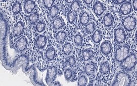 Anti-Tubulin γ-2 Antibody, clone 1M19 ZooMAb® Rabbit Monoclonal recombinant, expressed in HEK 293 cells