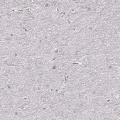 Anti-ZP3 antibody produced in rabbit Prestige Antibodies&#174; Powered by Atlas Antibodies, affinity isolated antibody, buffered aqueous glycerol solution